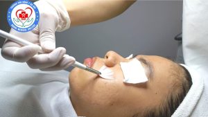 Công nghệ pell da trong chăm sóc sắc đẹp